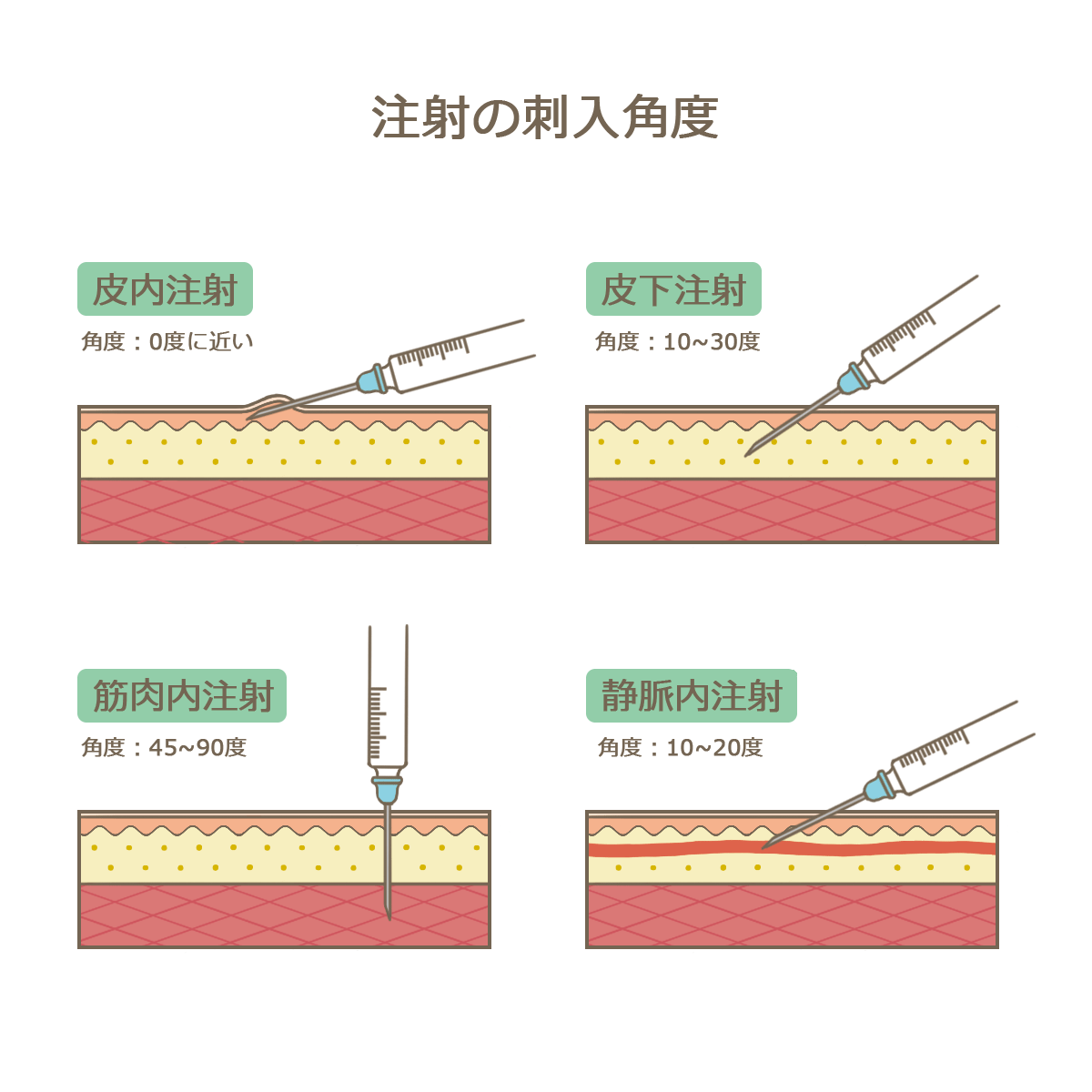 筋肉注射を学ぼう（おすすめYouTube紹介） | クマブロ